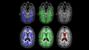 MRI and Human Brains