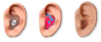 custom ear molds